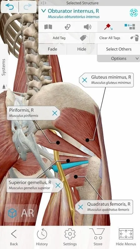 Mod de Human Anatomy Atlas 2021 mostrando información sobre enfermedades